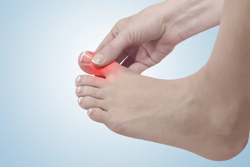 Blog - Wat doe je bij een gekneusde teen